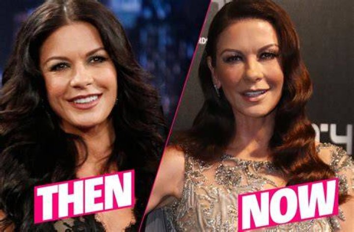 Catherine Zeta Jones Breast Implants Plastic Surgery Before and After