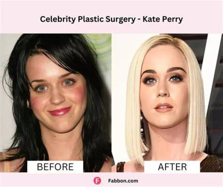 Matthew Perry Plastic Surgery Before and After