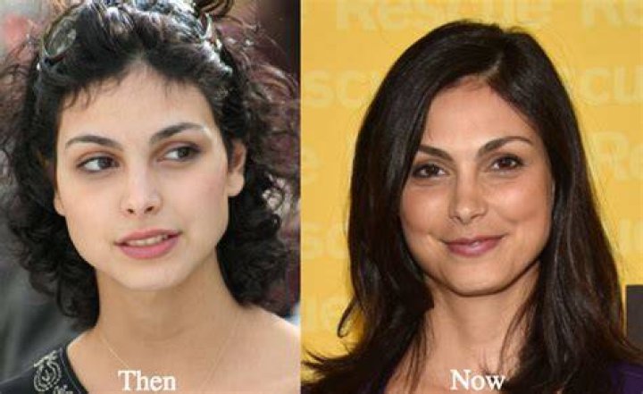 Morena Baccarin Nose Job Plastic Surgery Before and After